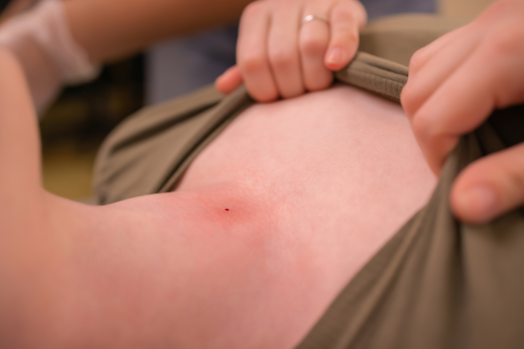 Cum scăpăm de ploșnițe 