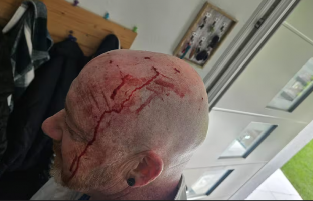 Elvețian atacat de o pasăre de pradă, în timp ce făcea jogging în parc: „A venit din spate de mai multe ori”. Ce spun experții