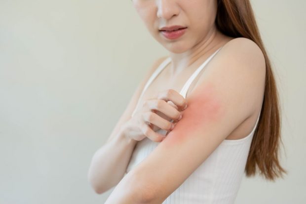 Remedii eficiente pentru alergia la soare – ce este alergia la soare