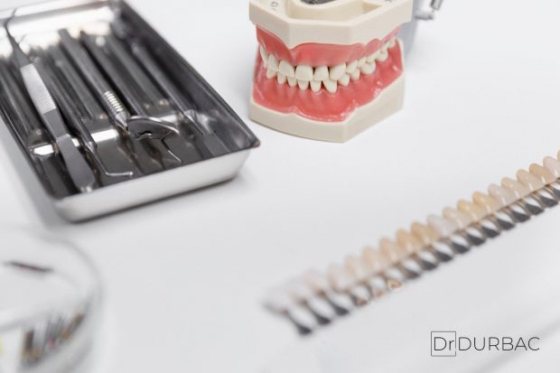 Care e varianta optimă: proteză dentară fără implant sau proteză fixă? Vezi despre fiecare în parte