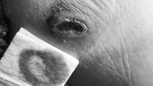 Ce a pățit o tânără din Elveția care a adormit pe încărcătorul de telefon băgat în priză: „Îmi voi face un tatuaj”. Imagini care vă pot afecta emoțional