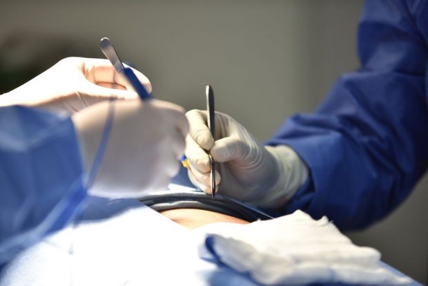 Primul transplat de inimă robotică din lume, făcut cu succes într-un spital din Arabia Saudită. Cine este pacientul | VIDEO