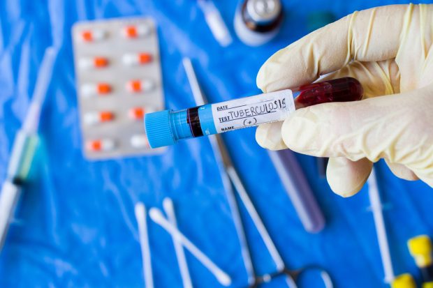Tuberculoza a revenit pe prima poziție în clasamentul bolilor infecțioase mortale