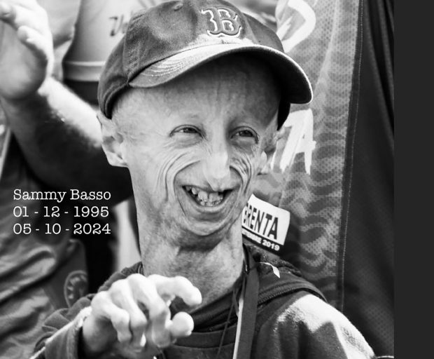 Sammy Basso, cel mai longeviv supraviețuitor diagnosticat cu progeria, o boală genetică rară, a murit la 28 de ani