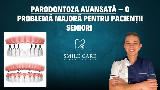 Studiu SMILE CARE: Parodontoza avansată – o problemă majoră pentru pacienții seniori 