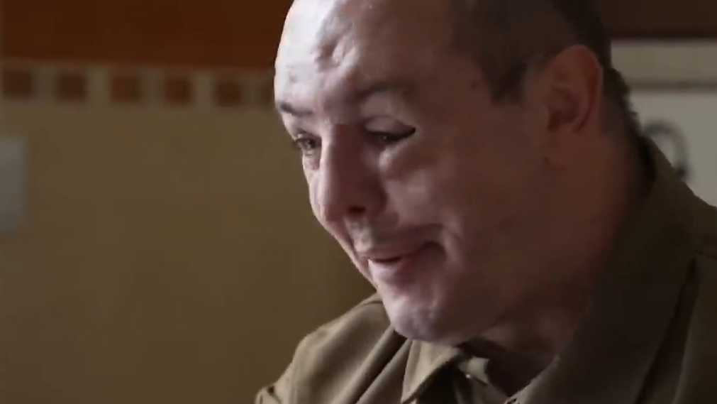 Chipurile mutilate de război. Amploarea rănilor faciale este atât de gravă, încât experții spun că amintește de războaiele din secolul trecut