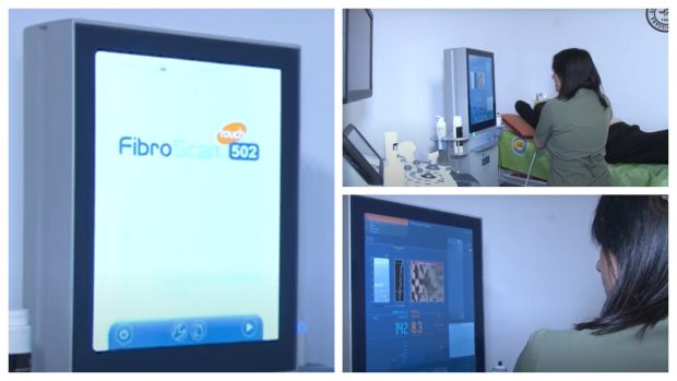 Investigații gratuite pentru ficat, la un spital din Timișoara, cu ajutorul unui dispozitiv Fibroscan  | VIDEO