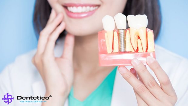 Ghid complet pentru îngrijirea dinților după un implant dentar