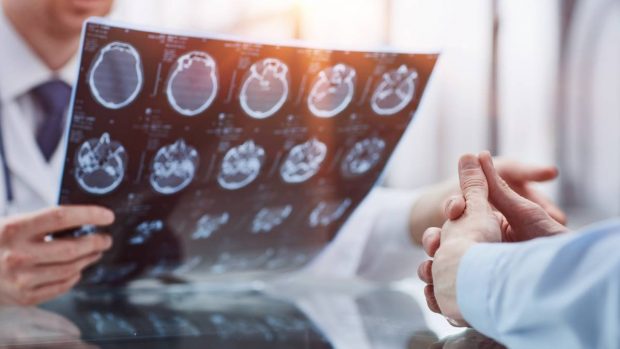 Ipoteză revoluționară: Alzheimerul ar putea fi declanșat de infecții virale