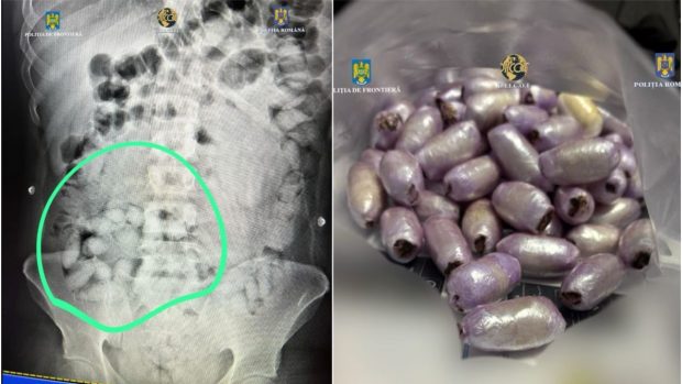 Un brazilian care înghițise capsule cu cocaină și avea altele lipite pe picioare, prins pe Aeroportul Otopeni din București – Foto