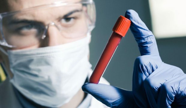 „Testul de colesterol pentru creier”, cheia depistării precoce a bolii Alzheimer