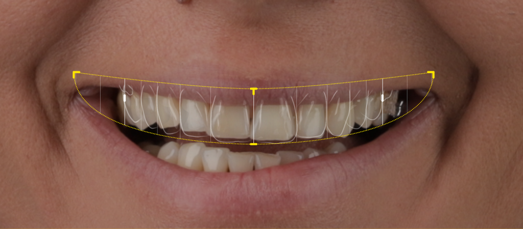 Estetica dentară la alt nivel