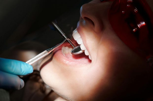 Etapele procedurii de implant dentar – ce trebuie să știi