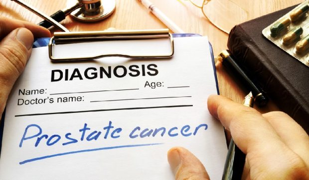 Un test cu salivă ar putea schimba lupta împotriva cancerului de prostată