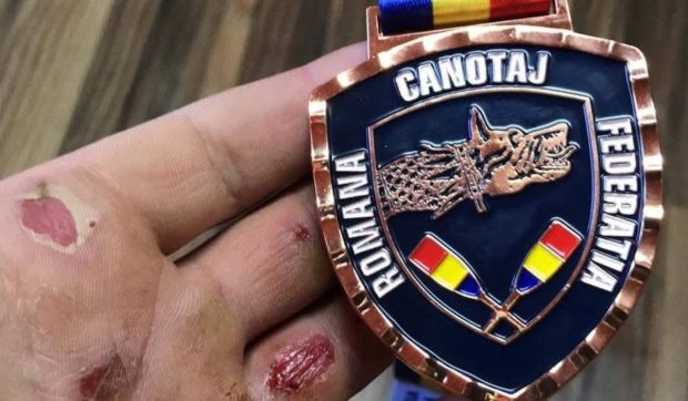 Cum arată mâinile unui medaliat cu aur la Europenele de canotaj: „Cel mai valoros premiu te așteaptă acasă”