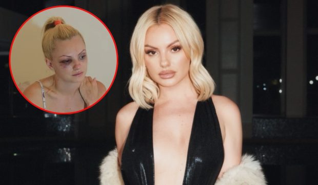 Crima din Cosmopolis a redeschis răni vechi pentru Alexandra Stan. Artista a fost victima violenței în trecut: „Agresiunea nu e doar cea fizică, ci și psihică și emoţională”