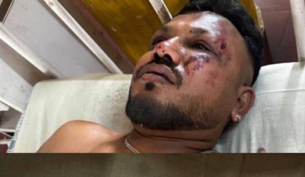 Un bărbat a supraviețuit miraculos prăbușirii avionului în India. Mărturiile cetățeanului britanic despre momentul impactului