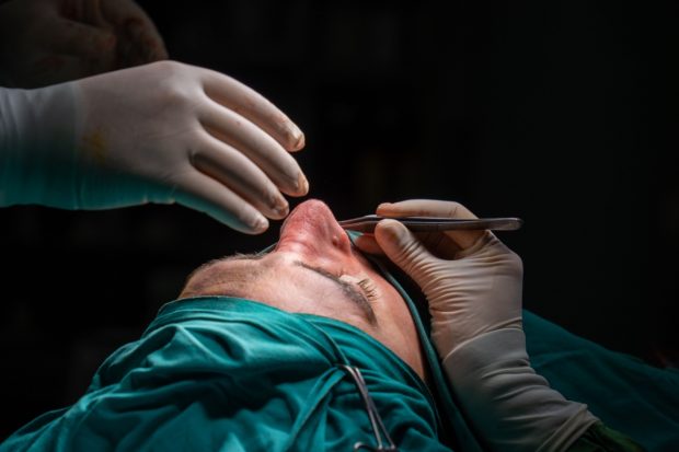 Rinoplastie estetică sau septoplastie? Diferențe și recomandări