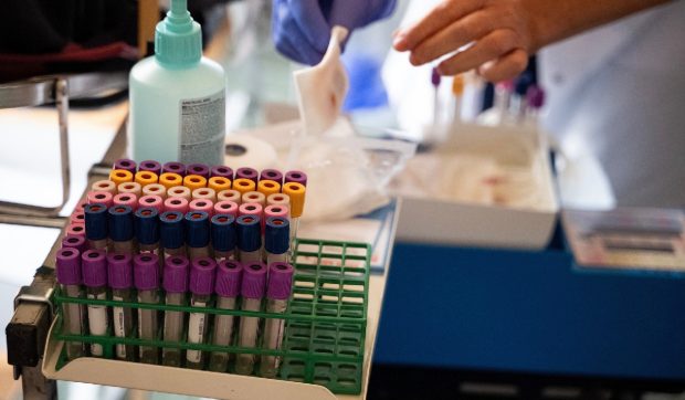 Testul de sânge revoluționar care detectează cancerul cu câțiva ani înainte ca simptomele să apară