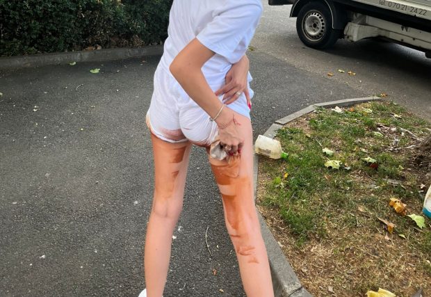 „A început să zbiere, mi-a spus să mă spăl cu benzină”: pățania tinerei care s-a așezat pe o bancă proaspăt vopsită și nesemnalizată din Sibiu