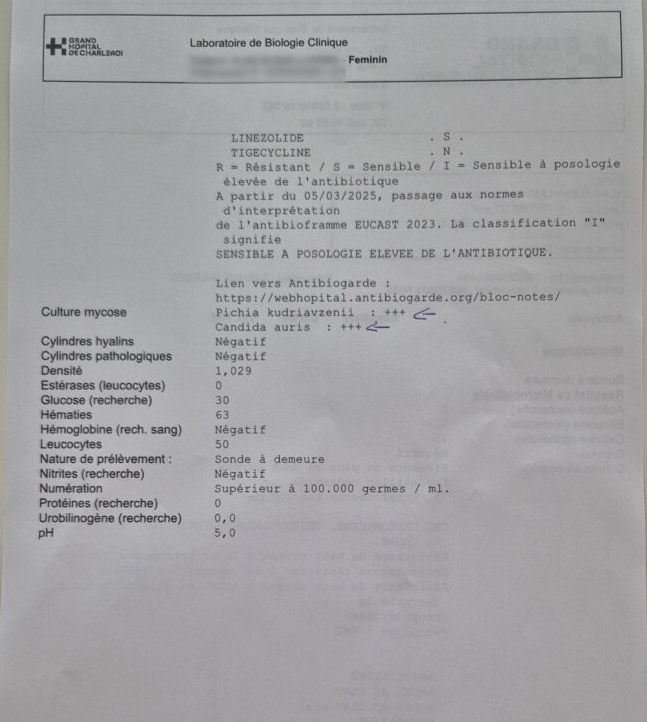 Dovada că medicii de la Centrul de Arși știau că Lavinia este infectată cu Candida auris, dar nu au spus: „Niște criminali. O lăsau să moară în România”