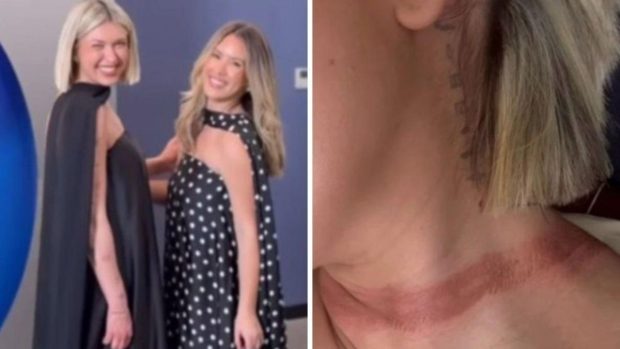 O influenceriță a fost „aproape decapitată” după ce eșarfa de mătase i s-a prins în mașină