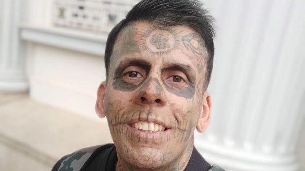 Dependentul de tatuaje care și-a pictat 95% din corp arată de nerecunoscut, după ce și le-a scos printr-o procedură dureroasă