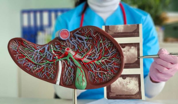 Oamenii de știință au descoperit principala cauză a afecțiunilor care distrug ficatul. Un nou tratament pentru bolile hepatice