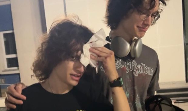 Imagine Stire Ce a pățit un influencer venit din SUA după ce a mers cu trotineta prin București: „Noroc că eram în fața spitalului” | 2review.ro
