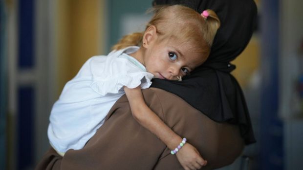 Povestea fetiței de 2 ani evacuată din Gaza și salvată de medici în Italia în ultimul moment: cântărea doar patru kilograme