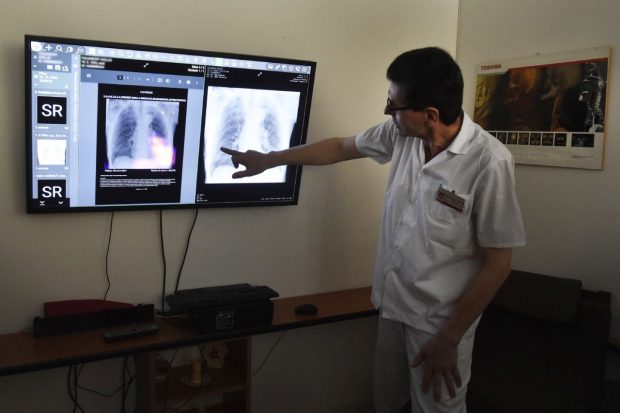 „Plămânul pe cip” care respiră ca unul real: descoperire ce promite să schimbe cercetarea medicală