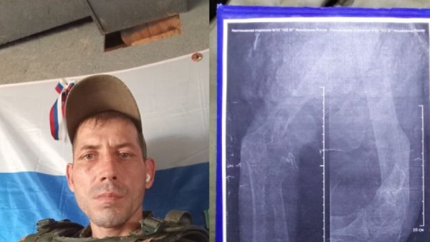 Foștii prizonieri ruși de război răniți sunt trimiși înapoi la luptă: „Am un glonț în mine și mâna fracturată în multe locuri. Suntem schilozi pe frontul din Donețk”