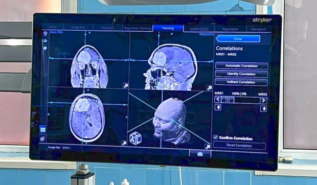 Operație pe creier la Galați, în premieră, realizată cu ajutorul Sistemului de Neuronavigație: Funcționează ca un GPS