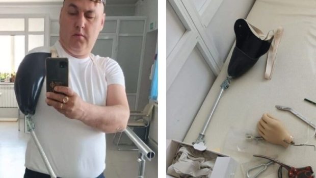 Rușii n-au proteze pentru soldații mutilați în război. Jumătate dintre răniți au suferit amputări