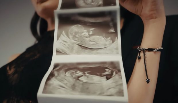 Imagine Stire O cântăreață din România a anunțat că este însărcinată la doar câteva luni după ce a început o nouă relație | 2review.ro
