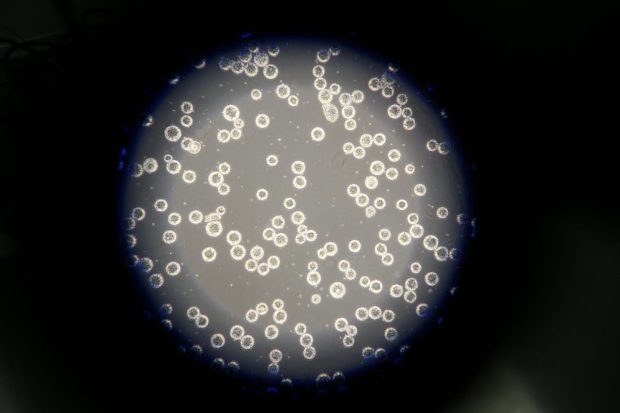 Distrugerea „celulelor zombi” din vasele de sânge ar ajuta tratamentul împotriva diabetului