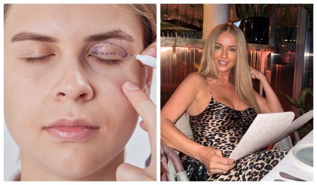 Imagine Stire Ce este blefaroplastia, intervenția momentului în estetica facială. Ce vedete apelează la această procedură și ce spune specialistul | 2review.ro