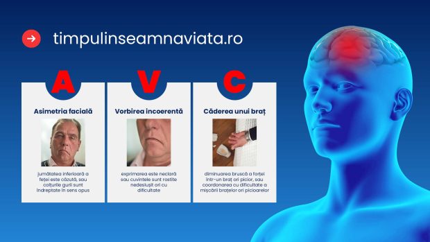 Accidentul vascular cerebral, o urgență medicală majoră