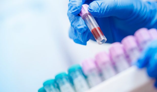 Depistarea cancerului cu un simplu test de sânge: o soluție promițătoare?
