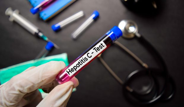 Testări gratuite pentru hepatita B și C pentru toți cei care prezintă simptome, anunță Ministerul Sănătății