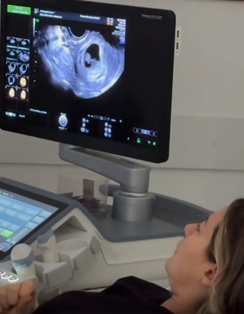 laura cosoi insarcinata pentru a cincea oara 7