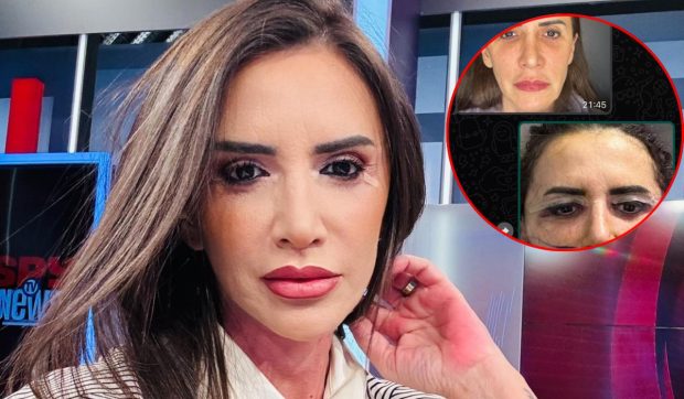 Imagine Stire Cum arăta Mara Bănică înainte de liftingul facial. Motivul pentru care a apelat la medicul estetician: „Nu mi-a fost rușine cu cine sunt” | 2review.ro
