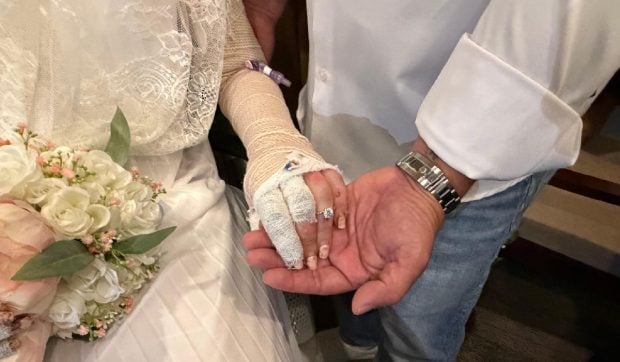 Un spital din Florida a organizat nunta unei paciente cu arsuri grave suferite într-un accident la grătar