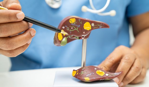 Avertismentul medicilor: Ficatul gras îmbolnăvește inima. Campania care explică de ce steatoza nu este un diagnostic banal