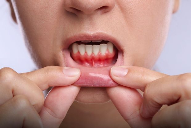 Importanța sănătății gingiilor în obținerea unui zâmbet estetic și durabil