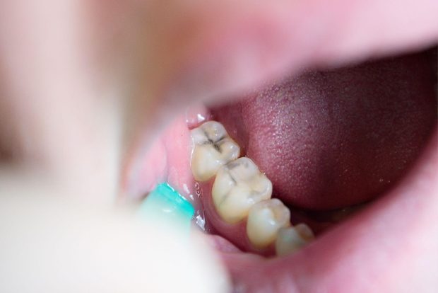 Revoluția ceramicii dentare: soluții estetice și durabile pentru zâmbete moderne