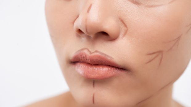 Colegiul Medicilor anchetează decesul pacientei după un mini-lifting facial într-o clinică din București