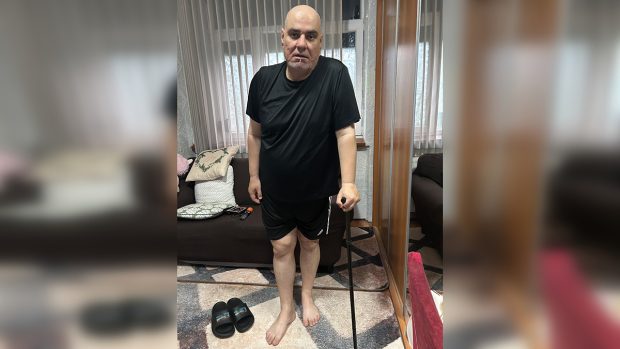 Un bărbat din Ilfov riscă să ajungă în scaun cu rotile din cauza coxartrozei: operația salvatoare costă aproape 10.000 de euro