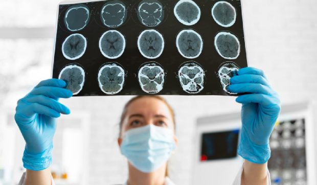Peste 60.000 de români suferă anual traumatisme craniene grave! Accidentele rutiere fac prăpăd: costul tratamentului pentru un singur pacient poate ajunge la 4 milioane de dolari