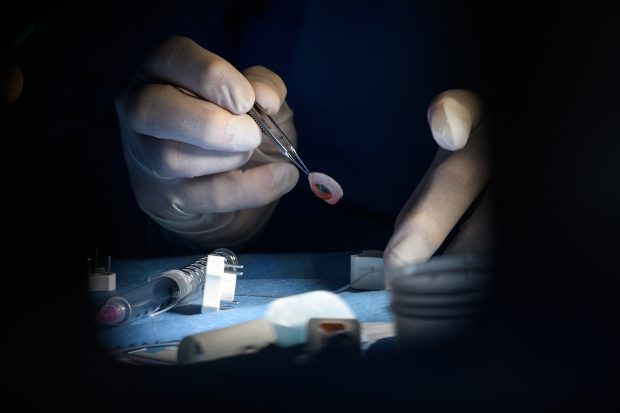 Dispozitiv inedit susține refacerea și conservarea ochilor prelevați pentru transplanturi viitoare